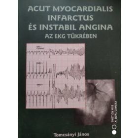   Tomcsányi János: Acut myocardialis infarctus és instabil angina az EKG tükrében