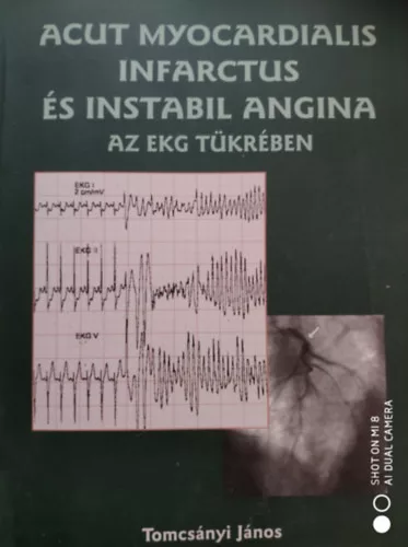 Tomcsányi János: Acut myocardialis infarctus és instabil angina az EKG tükrében