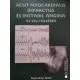 Tomcsányi János: Acut myocardialis infarctus és instabil angina az EKG tükrében