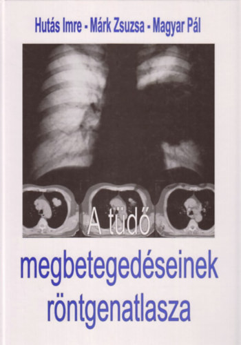Hutás, Márk, Magyar Pál: A tüdő megbetegedéseinek röntgenatlasza