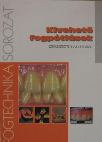 Hajdu Zoltán (szerk.): Kivehető fogpótlások
