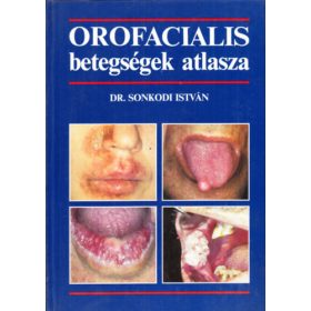 Dr. Sonkodi István: Orofacialis betegségek atlasza