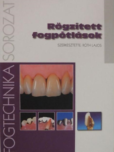 Róth Lajos (szerk.): Rögzített fogpótlások