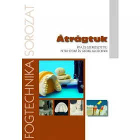 Peter Storz · Georg Gloeckner: Átrágtuk