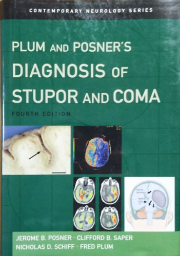 Plum and Posner's Diagnosis of Stupor and Coma (4th edition) - Jerome B. Posner - Clifford B. Saper - Nicholas D. Schiff - Fred Plum