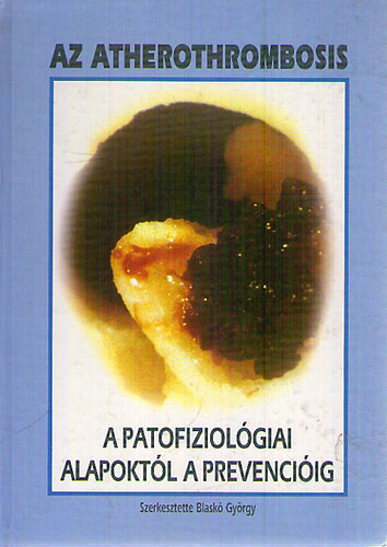 Dr. Blaskó György: Az atherothrombosis a patofiziológiai alapoktól a prevencióig