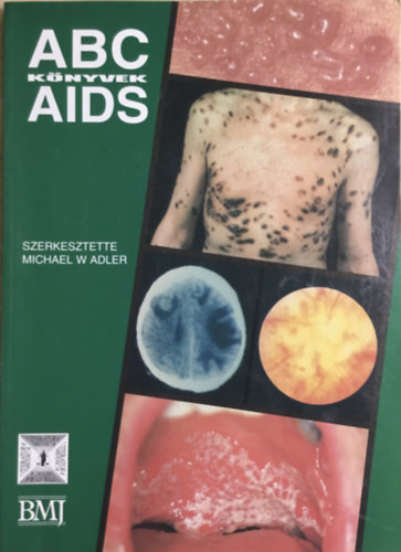ABC Könyvek AIDS - Michael W Adler