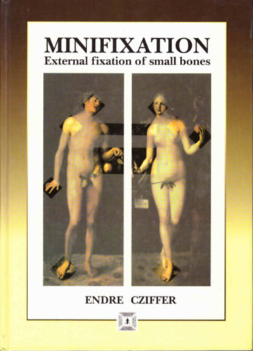 Minifixation: External Fixation of Small Bones - Cziffer Endre